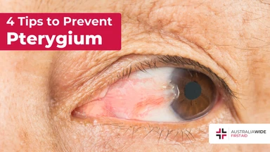 Prevent pterygium article header – First Aid Article in Belmont